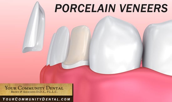 Cuidados Dentários, Braces, Tooth Gap, Your Community Dental, Implants, Veneers, Crowns, Bonding