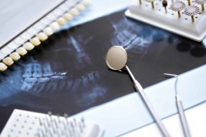 X-ray with teeth and dental instruments