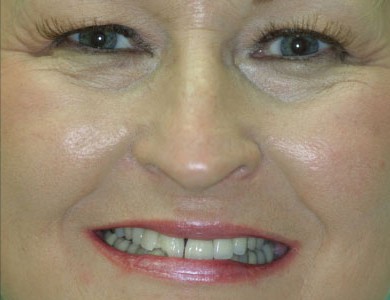 patti-b2