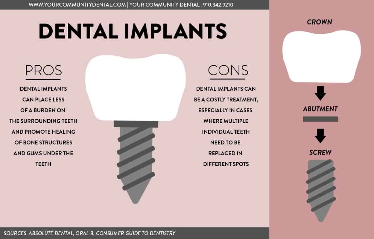 ProConImplant