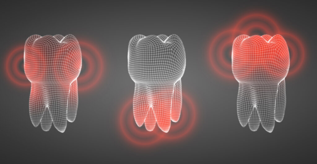 Dental Emergencies: What Can Wait and What Can’t?